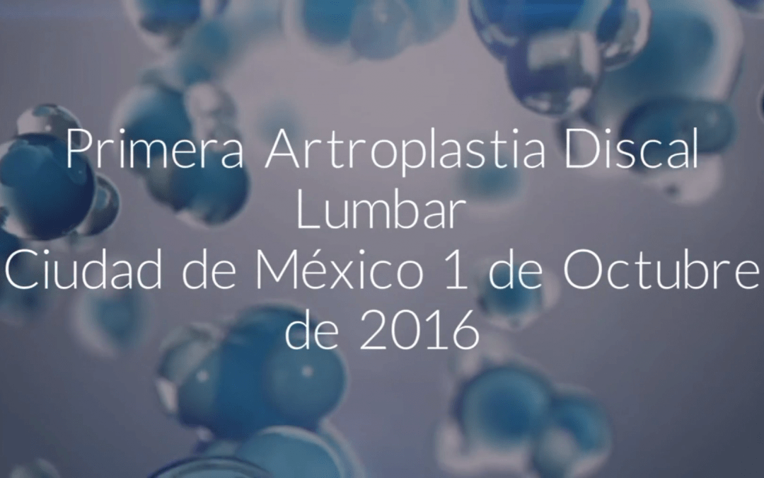 Primera Artroplastia Discal Lumbar practicada en México por la UIdCC