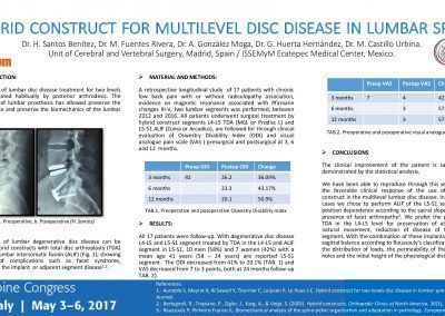 Hybrid Construct for Multilevel Disc Disease in Lumbar Spine