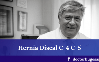Hernia discal cervical en C4 – C5